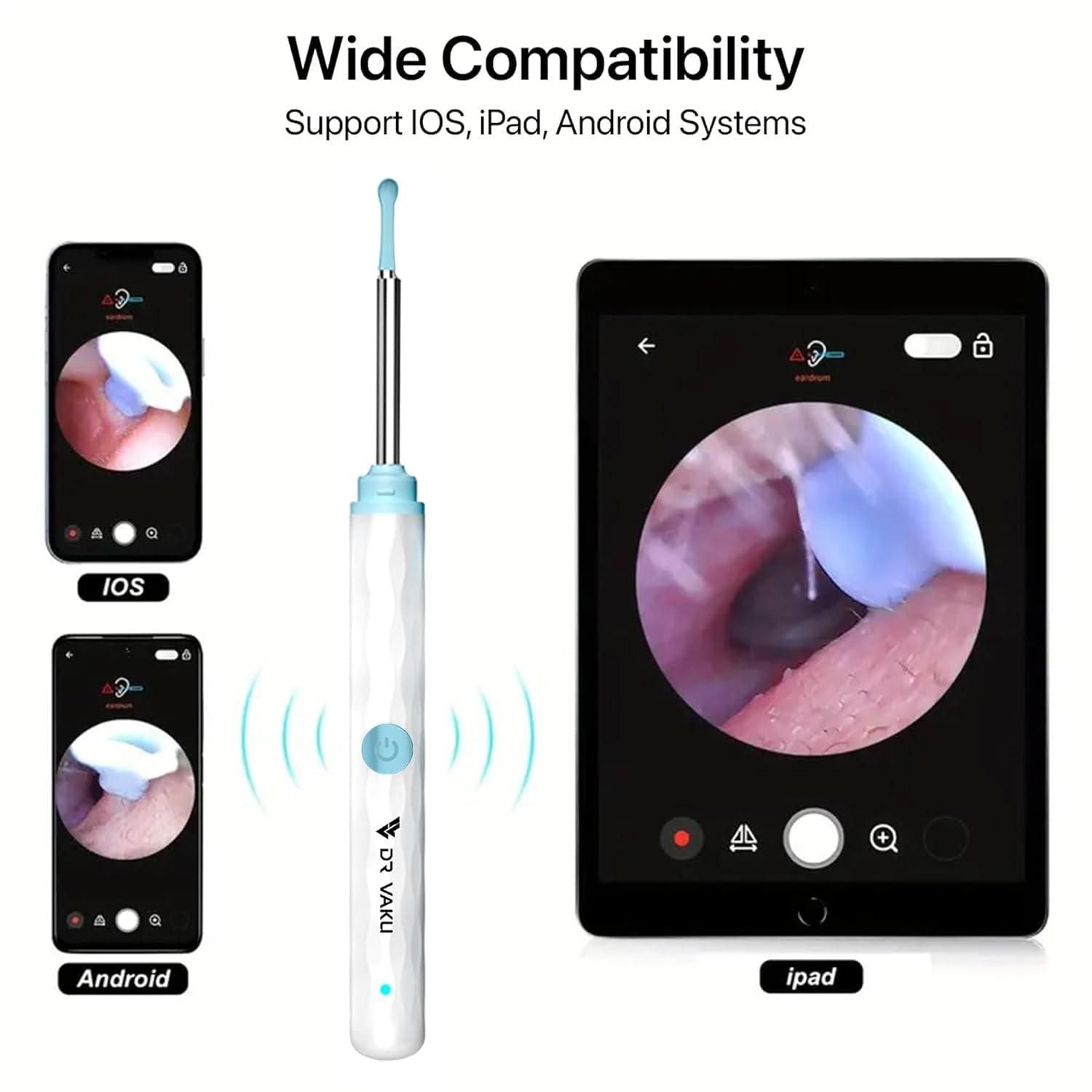 Wireless Ear Wax Removal Tool with HD Camera & 6 LED Lights