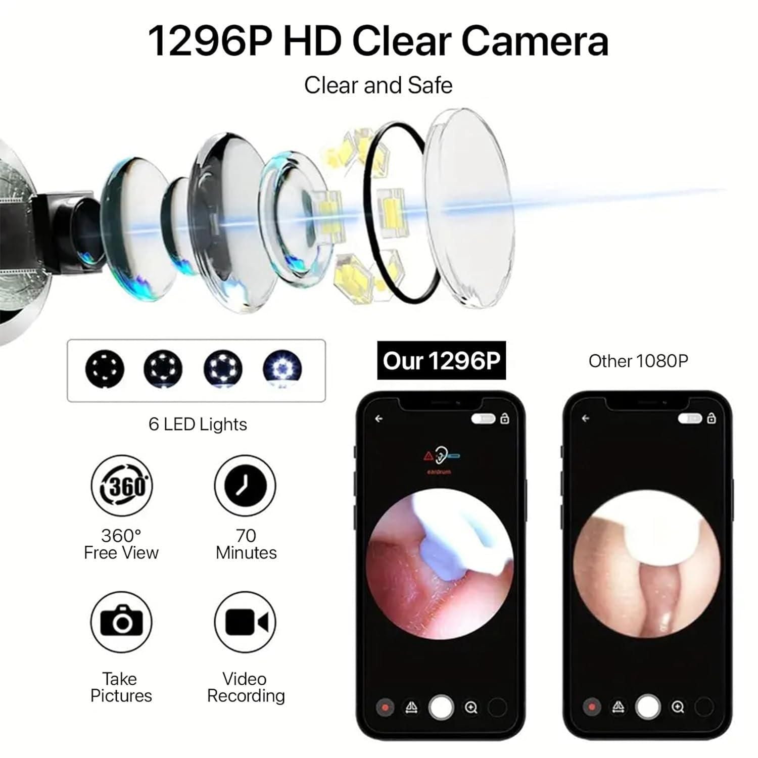 Wireless Ear Wax Removal Tool with HD Camera & 6 LED Lights